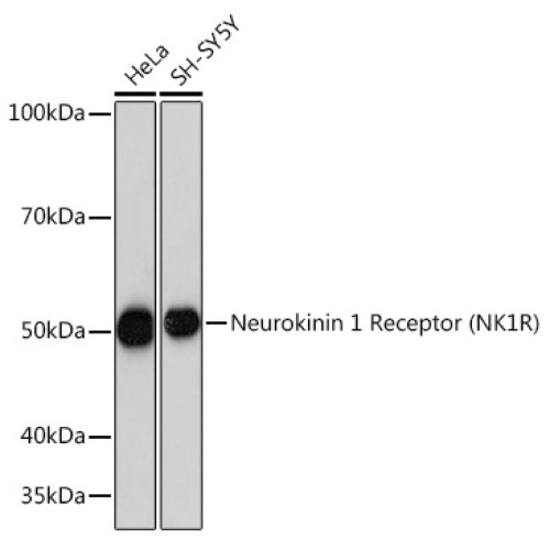 Neurokinin 1 Receptor (NK1R) Rabbit mAb