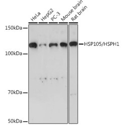 HSP105/HSPH1 Rabbit mAb