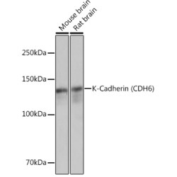 K-Cadherin (CDH6) Rabbit mAb