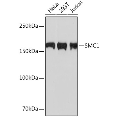 SMC1 Rabbit mAb