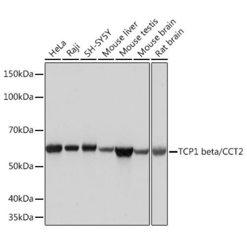 TCP1 beta/CCT2 Rabbit mAb