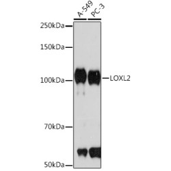 LOXL2 Rabbit mAb