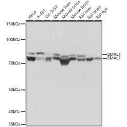 BMAL1 Rabbit mAb