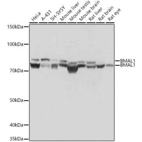 BMAL1 Rabbit mAb