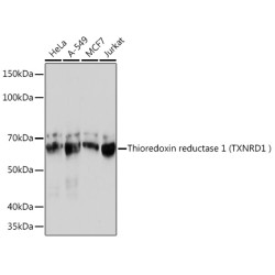 Human Thioredoxin Reductase 1/TRXR1 Rabbit mAb