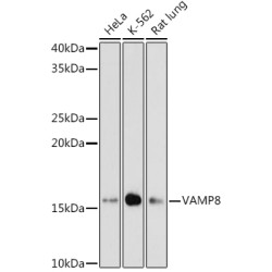 VAMP8 Rabbit mAb