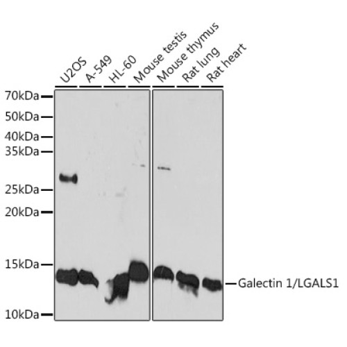 Galectin 1/LGALS1 Rabbit mAb