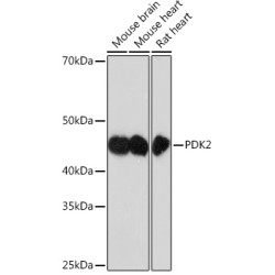 PDK2 Rabbit mAb