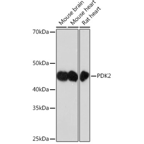 PDK2 Rabbit mAb