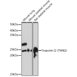 Troponin I2 (TNNI2) Rabbit mAb