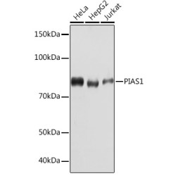 PIAS1 Rabbit mAb