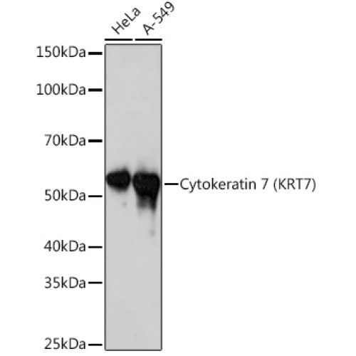 Cytokeratin 7 (KRT7) Rabbit mAb