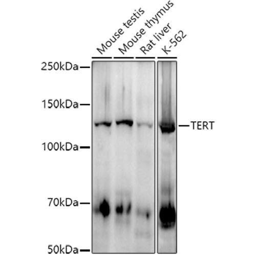 TERT Rabbit mAb