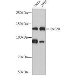 RNF20 Rabbit mAb