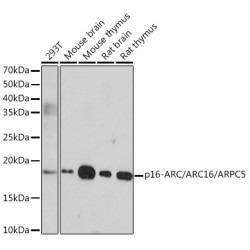 p16-ARC/ARC16/ARPC5 Rabbit mAb