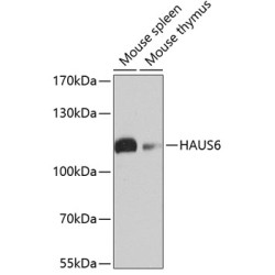 HAUS6 Rabbit pAb