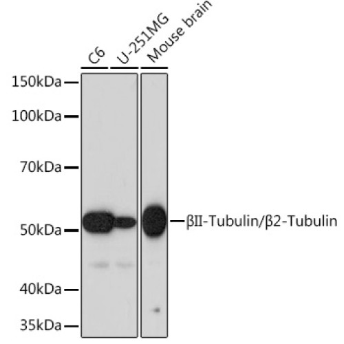 βII-Tubulin/β2-Tubulin Rabbit mAb