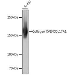 Collagen XVII/COL17A1 Rabbit mAb