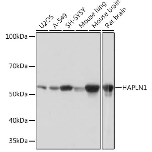 HAPLN1 Rabbit mAb