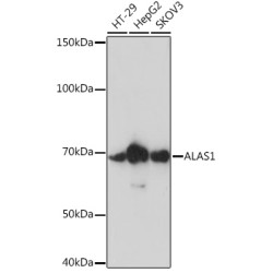 ALAS1 Rabbit mAb