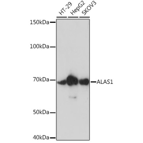 ALAS1 Rabbit mAb