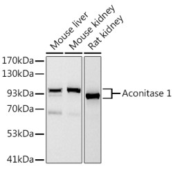 Aconitase 1 (ACO1) Rabbit mAb