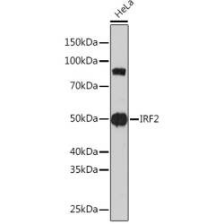 IRF2 Rabbit mAb