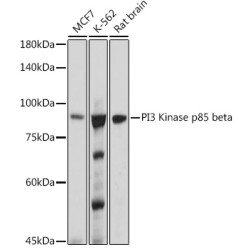 PI3 Kinase p85 beta Rabbit mAb