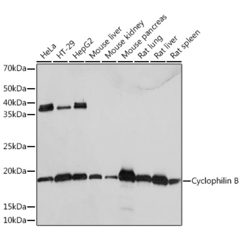 Cyclophilin B Rabbit mAb