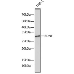 BDNF Rabbit mAb