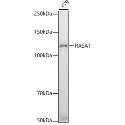 RASA1 Rabbit mAb
