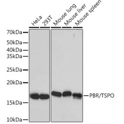 PBR/TSPO Rabbit mAb