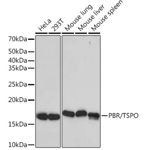 PBR/TSPO Rabbit mAb