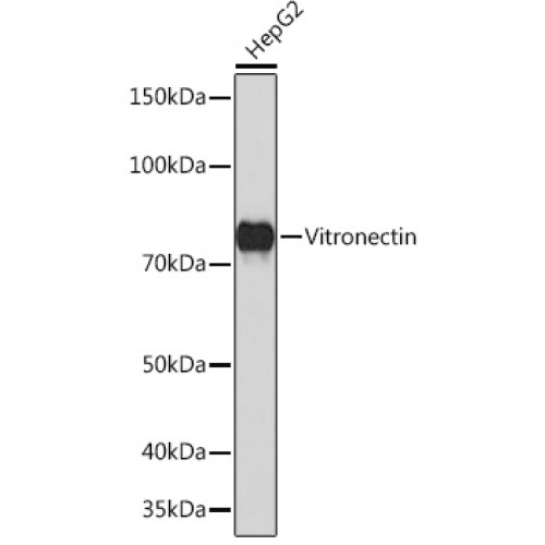 Vitronectin Rabbit mAb