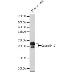 Caveolin-2  Rabbit mAb