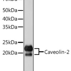 Caveolin-2  Rabbit mAb