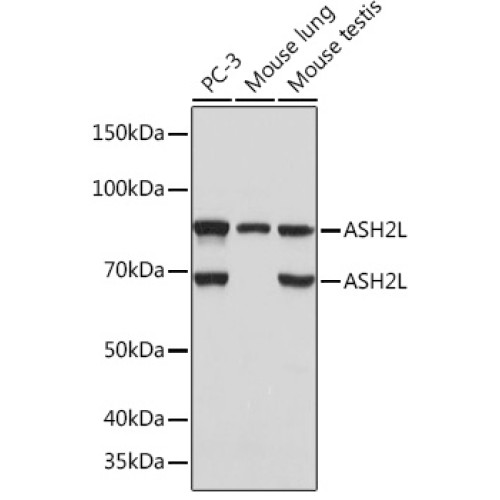 ASH2L Rabbit mAb