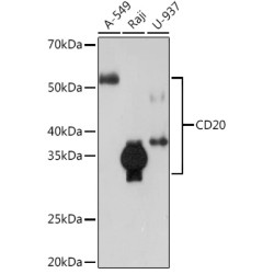 CD20 Rabbit mAb