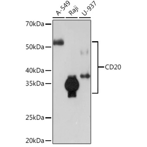 CD20 Rabbit mAb