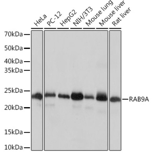 RAB9A Rabbit mAb