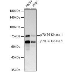 p70 S6 Kinase 1 Rabbit mAb