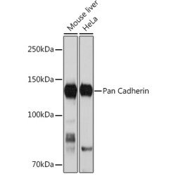 Pan Cadherin Rabbit mAb