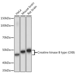 Creatine kinase B type (CKB) Rabbit mAb
