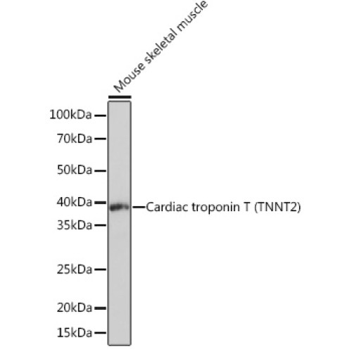 Cardiac troponin T (TNNT2) Rabbit mAb