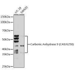Carbonic Anhydrase 9 (CA9/G250) Rabbit mAb