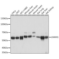 LMAN1 Rabbit mAb