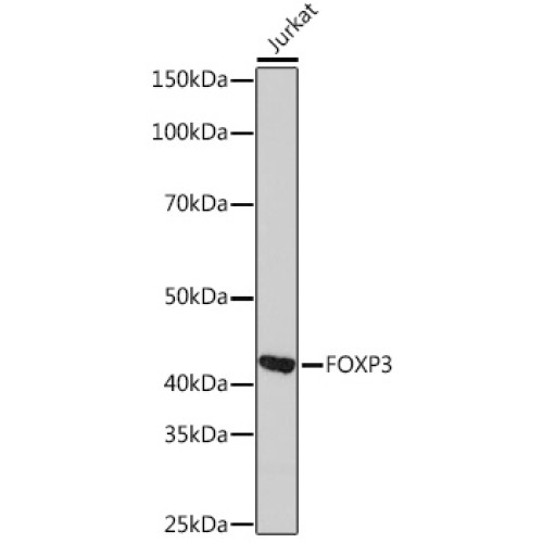FOXP3 Rabbit mAb