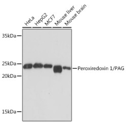 Peroxiredoxin 1/PAG Rabbit mAb