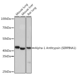 Alpha-1 Antitrypsin (SERPINA1) Rabbit mAb