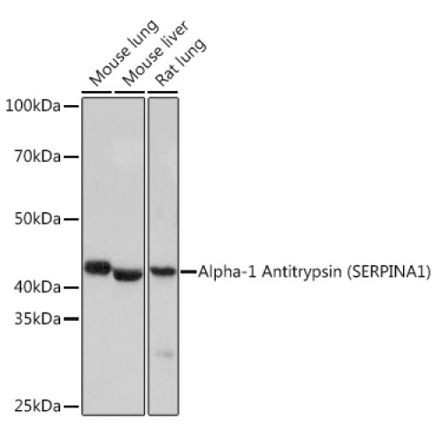 Alpha-1 Antitrypsin (SERPINA1) Rabbit mAb